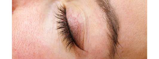 Cómo Usar un Sérum para Evitar Manchas en la Piel y Lograr un Tono Uniforme